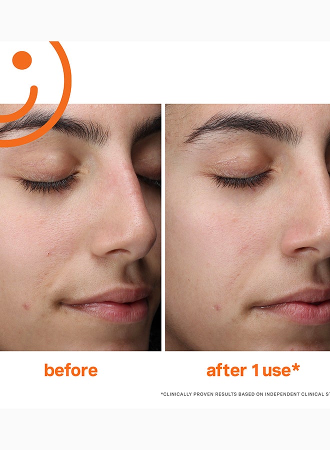 Kate Somerville ExfoliKate Daily Foaming Cleanser 120ml – Exfoliating Face Wash for Smooth & Clear Skin - Image 3